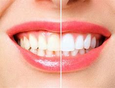 youll wonder where the yellow went when you brush your teeth with pepsodent